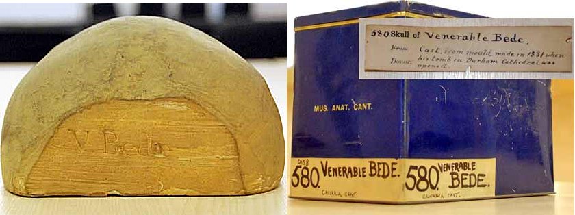 Skull of Bede