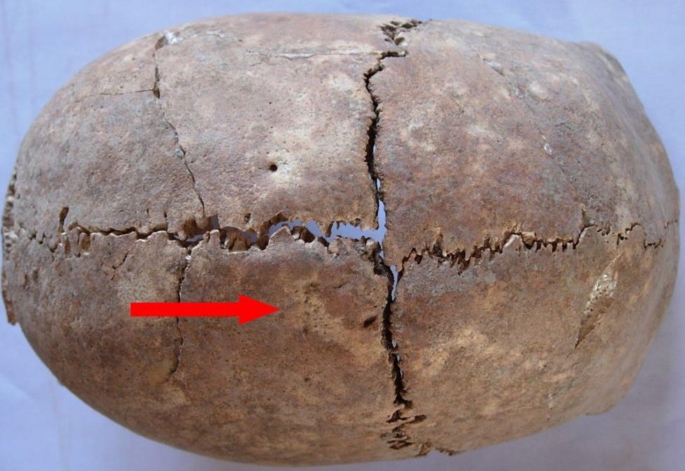 Skull with traces of healed trauma (the arrow) from Tell Majnuna, Syria, late Chalcolithic (c. 3500 BC). Photo by A. Sołtysiak