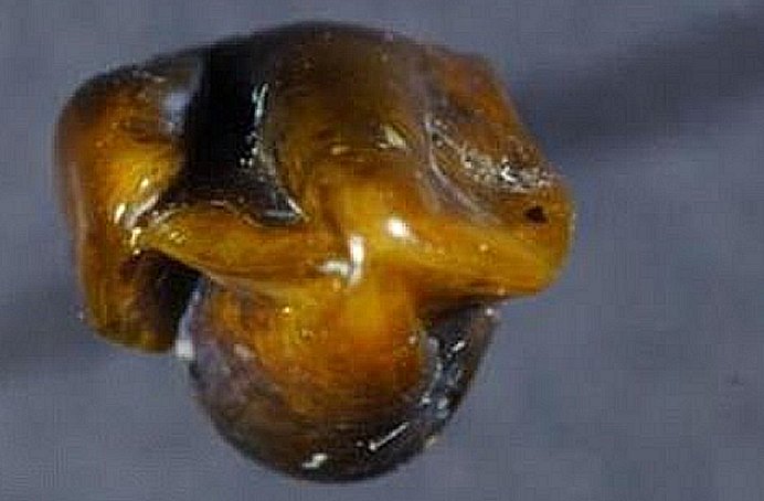 This find has a long, about 9.7 million years old history.Image credit: Mainz Natural History Museum