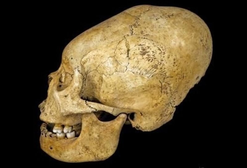 Ancient Cranial Modification In Peru Led To Social Inequality