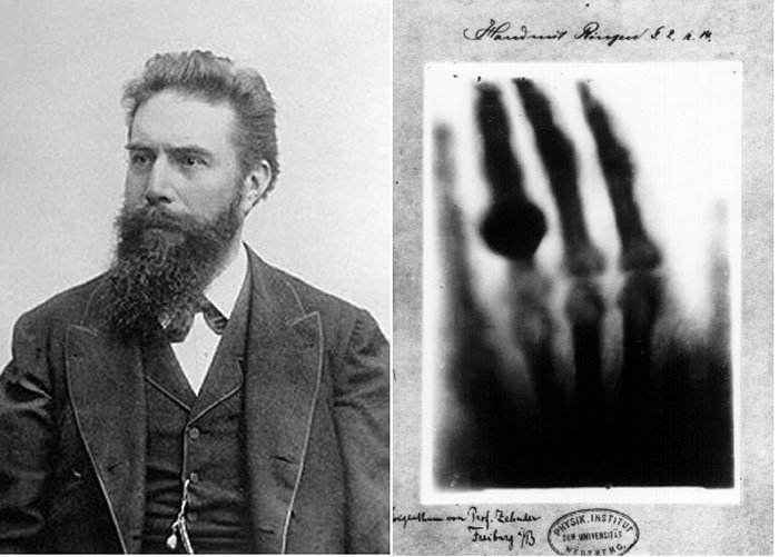 Left: Wilhelm Conrad Röntgen; Right: First medical X-ray by Wilhelm Röntgen of his wife Anna Bertha Ludwig's hand. Image: wikipedia