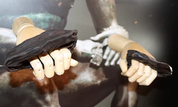 Unique Ancient Roman Boxing Gloves Discovered Near Hadrian’s Wall – The Only Surviving Example From 120 A.D.