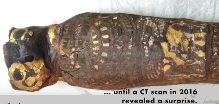 This was a preserved, pre-term male with well-proportioned arms and legs and well-formed tiny fingers and toes. He was just weeks away from what, under ordinary circumstances, might have been an ordinary birth. Credit: Maidstone Museum UK/Nikon Metrology UK