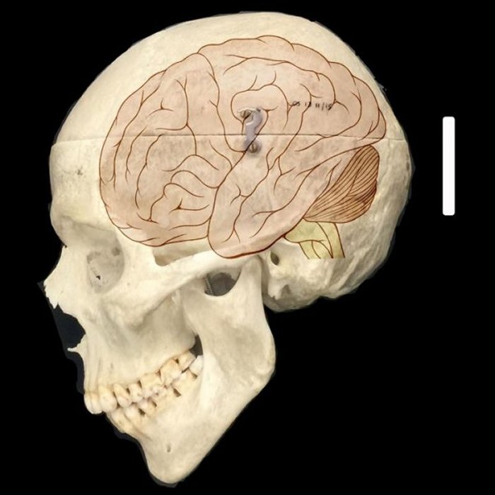 New Genes May Explain Why Humans Got Such Big Brains