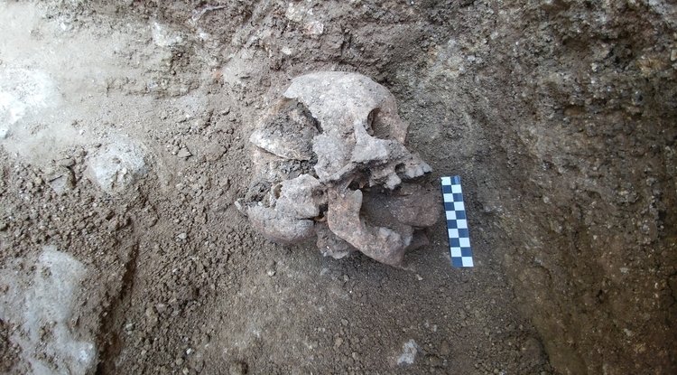 A rock was inserted into the mouth of a 10-year-old to keep the deceased child from rising from the grave and spreading malaria, researchers believe. (Photo courtesy of David Pickel/Stanford University)
