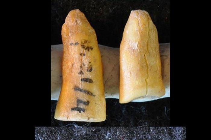 Humans developed therapeutic dental practices thousands of years before foods such as cereals and honey entered our diet. Image credit: Gregorio Oxilia