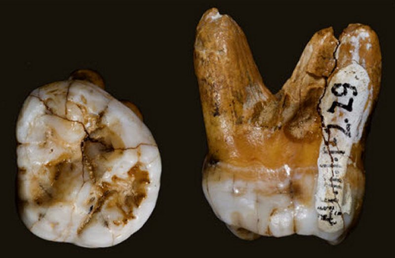The molar found in the Denisova cave, as seen from above and the side. Photo: courtesy David Reich/Nature