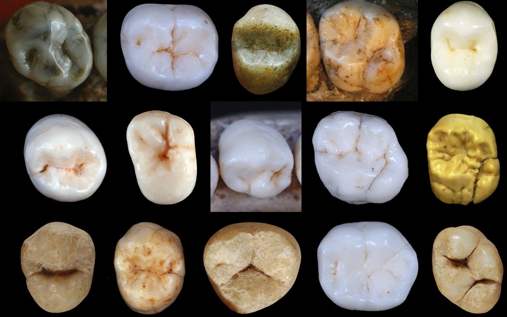 Dental morphology. Photo credit: Aida Gómez-Robles