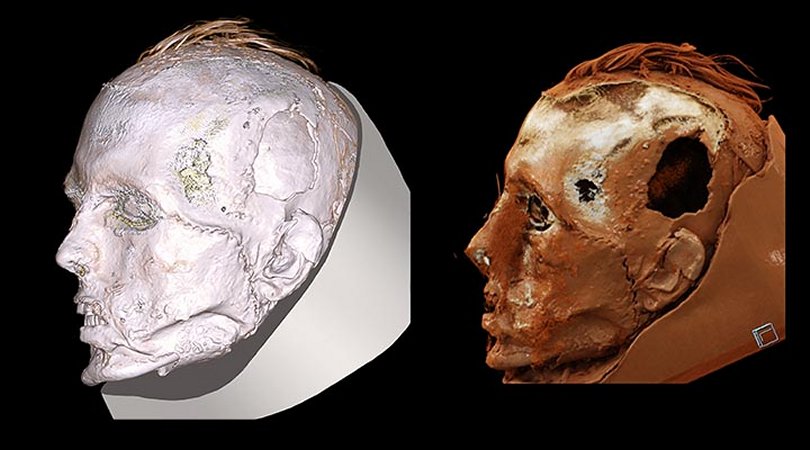 Never-Before-Seen Face Of A Tattooed Tashtyk Man Hidden Behind A Gypsum Death Mask Revealed