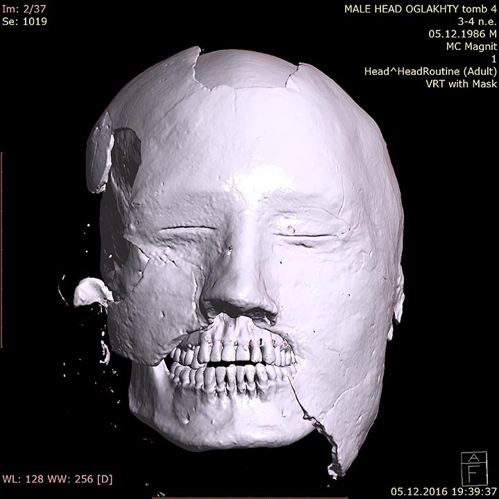 Never-Before-Seen Face Of A Tattooed Tashtyk Man Hidden Behind A Gypsum Death Mask Revealed