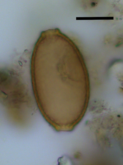 Prehistoric Feces At Stonehenge Reveal The Earliest Evidence For Intestinal Parasites In The UK