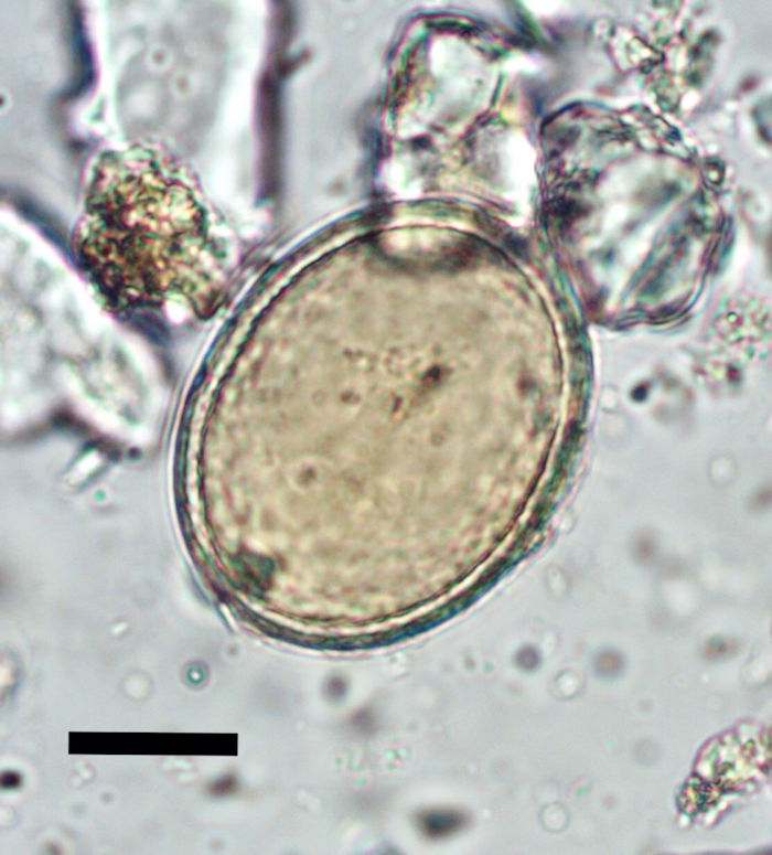 Medieval friars were 'riddled with parasites,' study finds