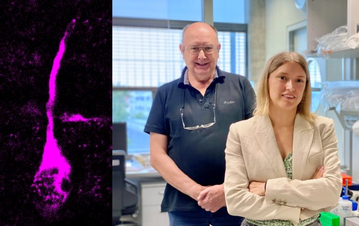 Microscopy picture of a dividing basal radial glial cell, a progenitor cell type that generates neurons during brain development. Modern human TKTL1, but not Neandertal TKTL1, increases basal radial glia and neuron abundance. Credit: Pinson et al., Science 2022 / MPI-CBG Left: Microscopy picture of a dividing basal radial glial cell, a progenitor cell type that generates neurons during brain development. Modern human TKTL1, but not Neandertal TKTL1, increases basal radial glia and neuron abundance. [less] © Pinson et al., Science 2022 / MPI-CBG; Right: Anneline Pinson is a researcher in Wieland Huttner's group. © MPI-CBG