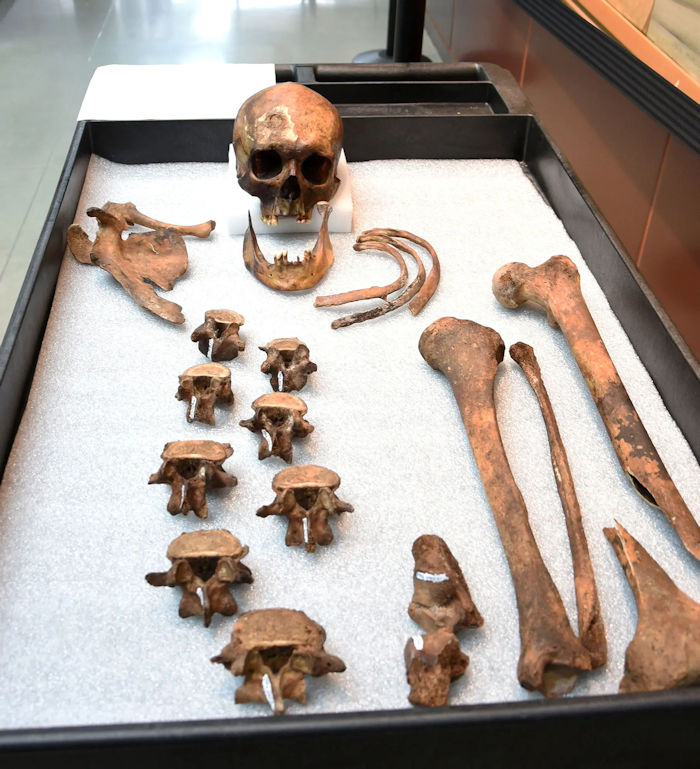 Face Of Very Old "Vampire" Buried In Connecticut Reconstructed