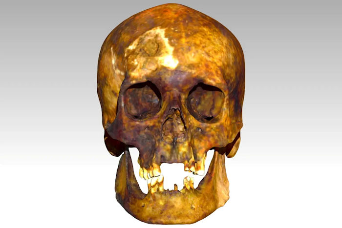 Face Of Very Old "Vampire" Buried In Connecticut Reconstructed