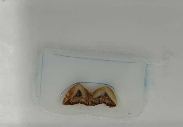 Tooth Enamel Reveals Life Histories Of Early Humans