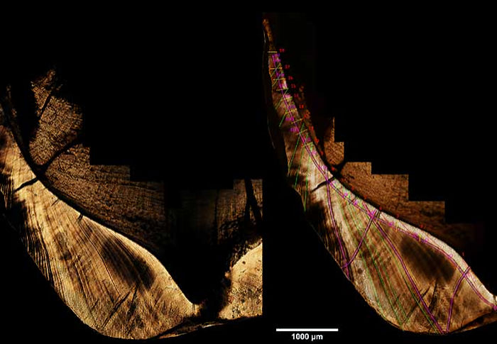 Tooth Enamel Reveals Life Histories Of Early Humans