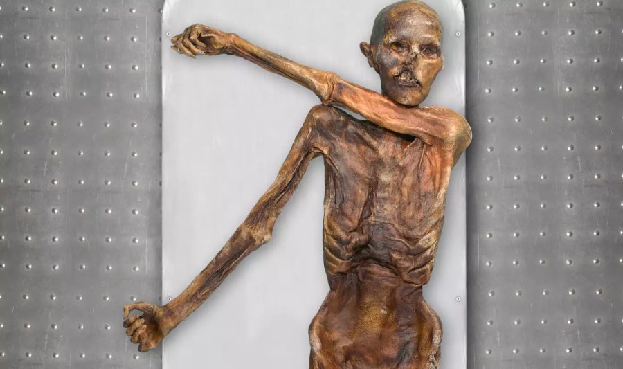 Ötzi Had Dark skin, Bald head And Anatolian Ancestry- DNA Reveals