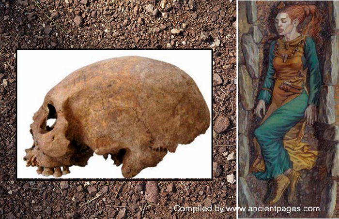 Unusual Viking Women With Elongated Heads On Gotland, Sweden