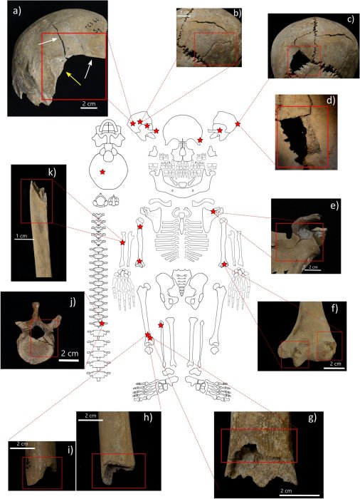 Mysterious Death Of 20 Celts Who Died 2,000 Years Ago In The Three Lakes, Switzerland - Re-Examined