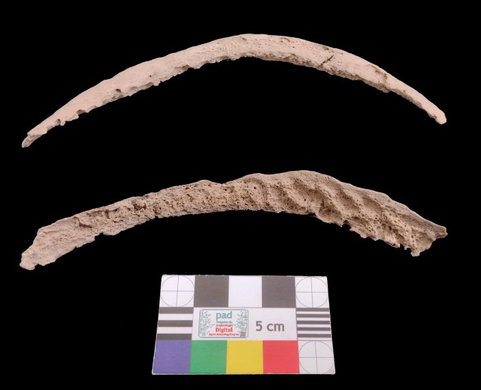 Ancient Bone Reveals Syphilis May Have Originated In The Americas - Columbus Theory Questioned By Scientists