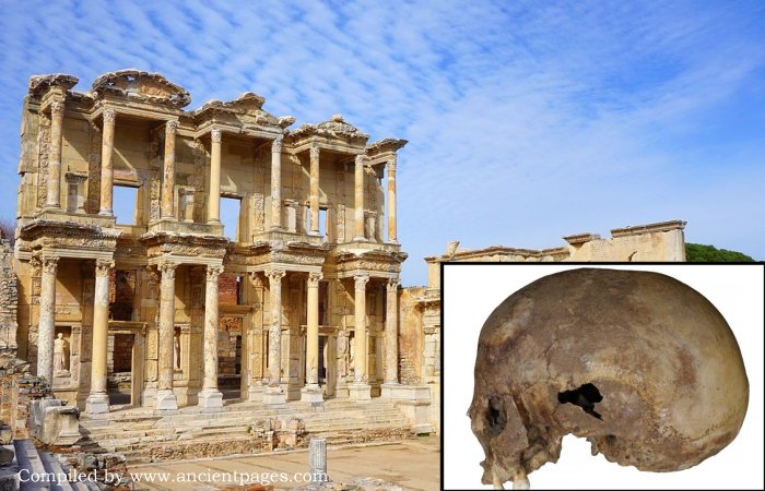 Mystery Of The Ancient Skull Found In Ephesus Solved - It Did Not Belong To Arsinoë IV, Cleopatra's Sister