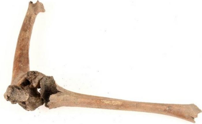 How Individuals With Disabilities Were Treated During The Late Middle Ages - Advanced Techniques Give Answers