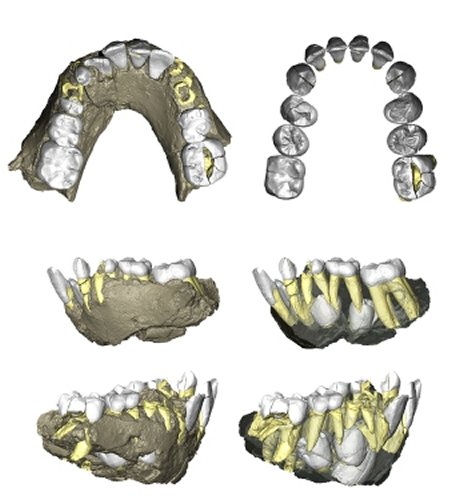 Burtele Foot Fossil Reveals Two Ancient Human Ancestors Lived Side by Side