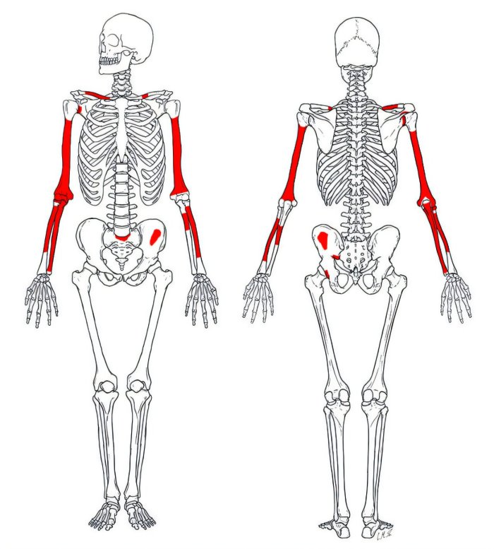 Oldest And Most Complete Skeleton Of 'Homo Habilis' Offers New Insight Into The Evolution Of Early Humans